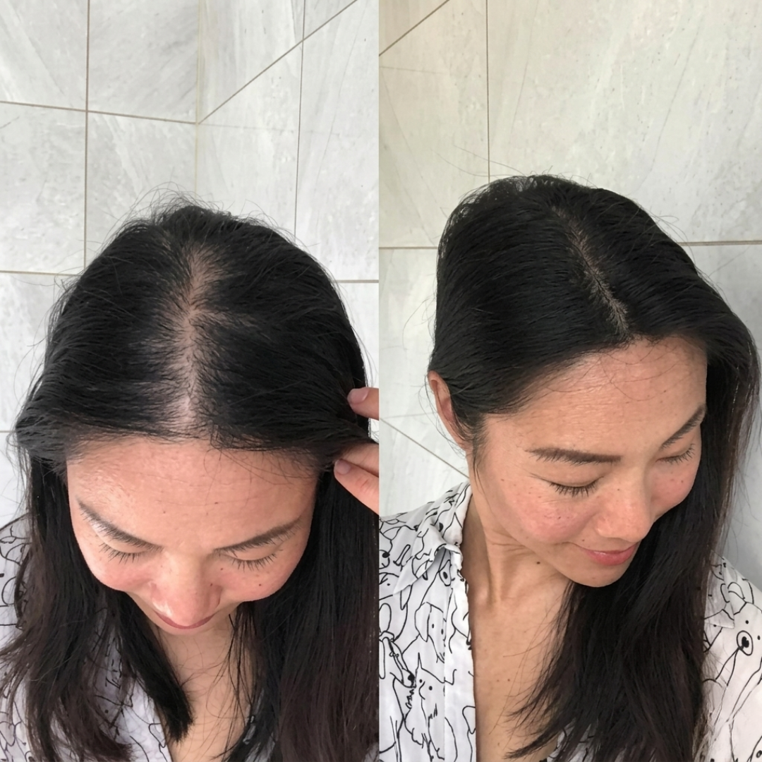 Tgideas Rosemary Amino Acid Shampoo – Strengthens Hair Roots, Promotes Hair Growth, Reduces Hair Fall – Deep Cleansing, Nourishing & Safe – For Dandruff, Oily Scalp, Dry & Frizzy Hair