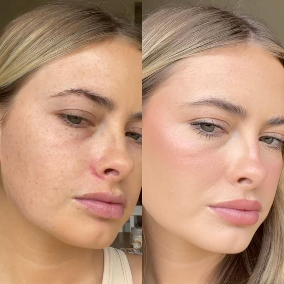 Maybelline New York Spot Rescue Concealer - Full Coverage Skin-Improving Concealer + Salicylic Acid – Conceals Acne & Blemishes, Improves Skin Over Time – 12HR Long-Lasting