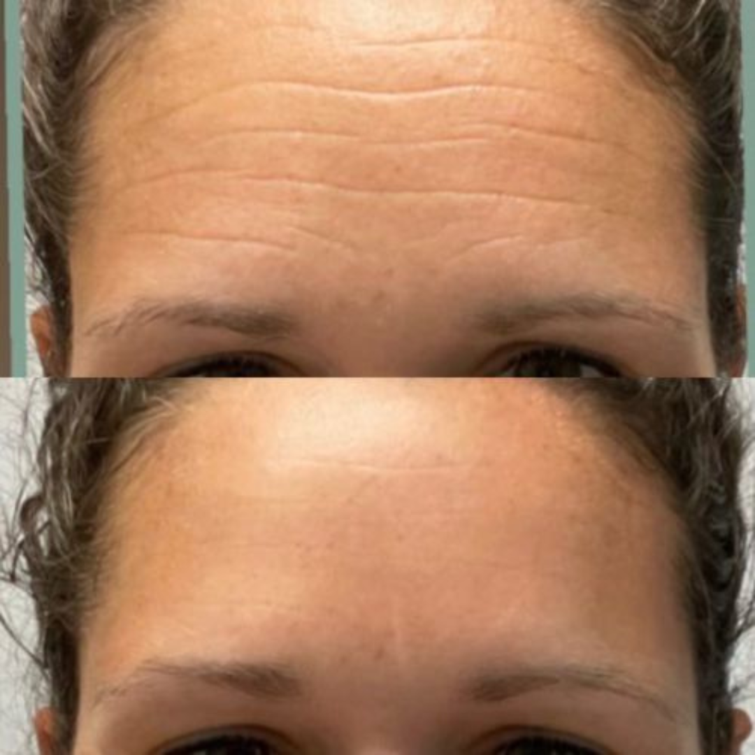 Dr. Melaxin Calcium Volume Multi Balm - Skin-Filling Care for Volume, Firmness & Radiance – With Calcium & Collagen Extract – Targets Forehead Wrinkles, Fine Lines, Smile Lines, Under-Eye Lines & Loss of Firmness – Hydrating & Moisturizing –