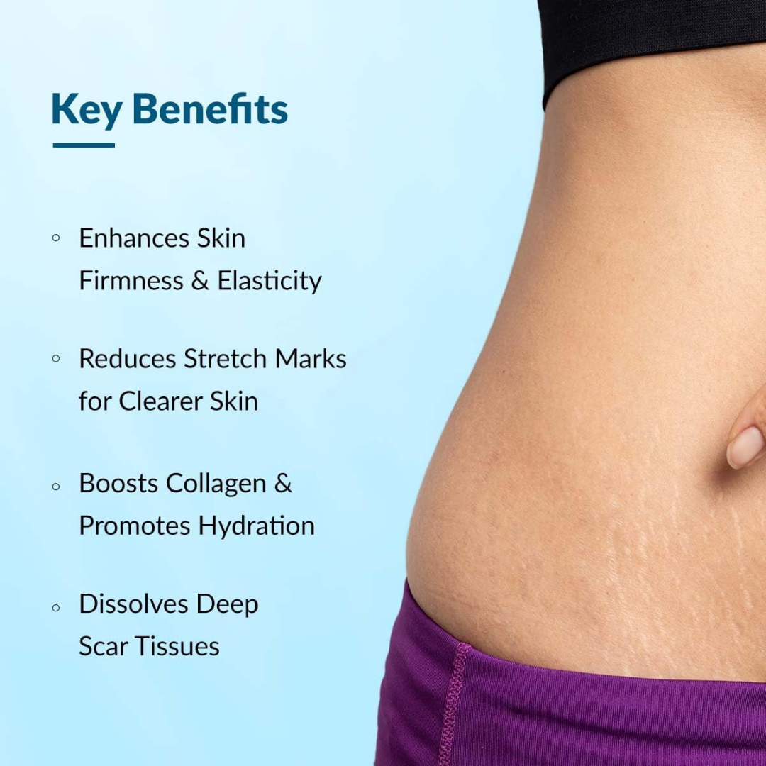 Hakim Suleman's Stretch Mark & Scar Removal Cream | Enriched with Almond, Olive & Sandalwood Oil | Reduces Stretch Marks, Scars & Improves Skin Elasticity