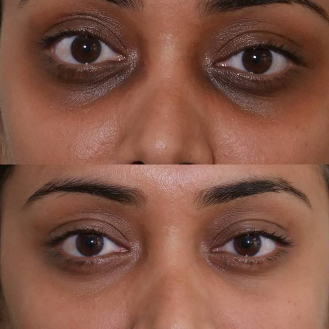 Arencia Vitamin C Booster Shot – Vitamin C Booster for Dark Spots, Uneven Tone, Fine Lines & Dullness – Deep Hydration, Antioxidant Protection