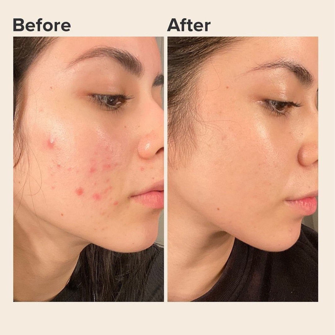 TYPSY BEAUTY FOUNDCEALER 3-in-1 – Foundation + Concealer + SPF 30 – Pakistan's First Dual Applicator (Pump + Wand) – Full Coverage, Breathable, Hydrating – FREE Beauty Blender