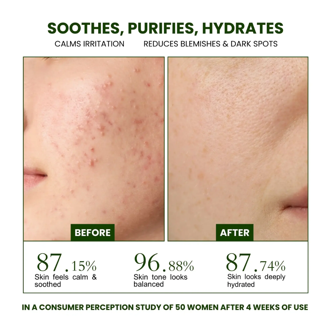 Muse Labs 7% Glycolic Acid Toner | Gentle AHA Exfoliant with Niacinamide & Aloe Vera | Smooth, Bright & Clear Skin