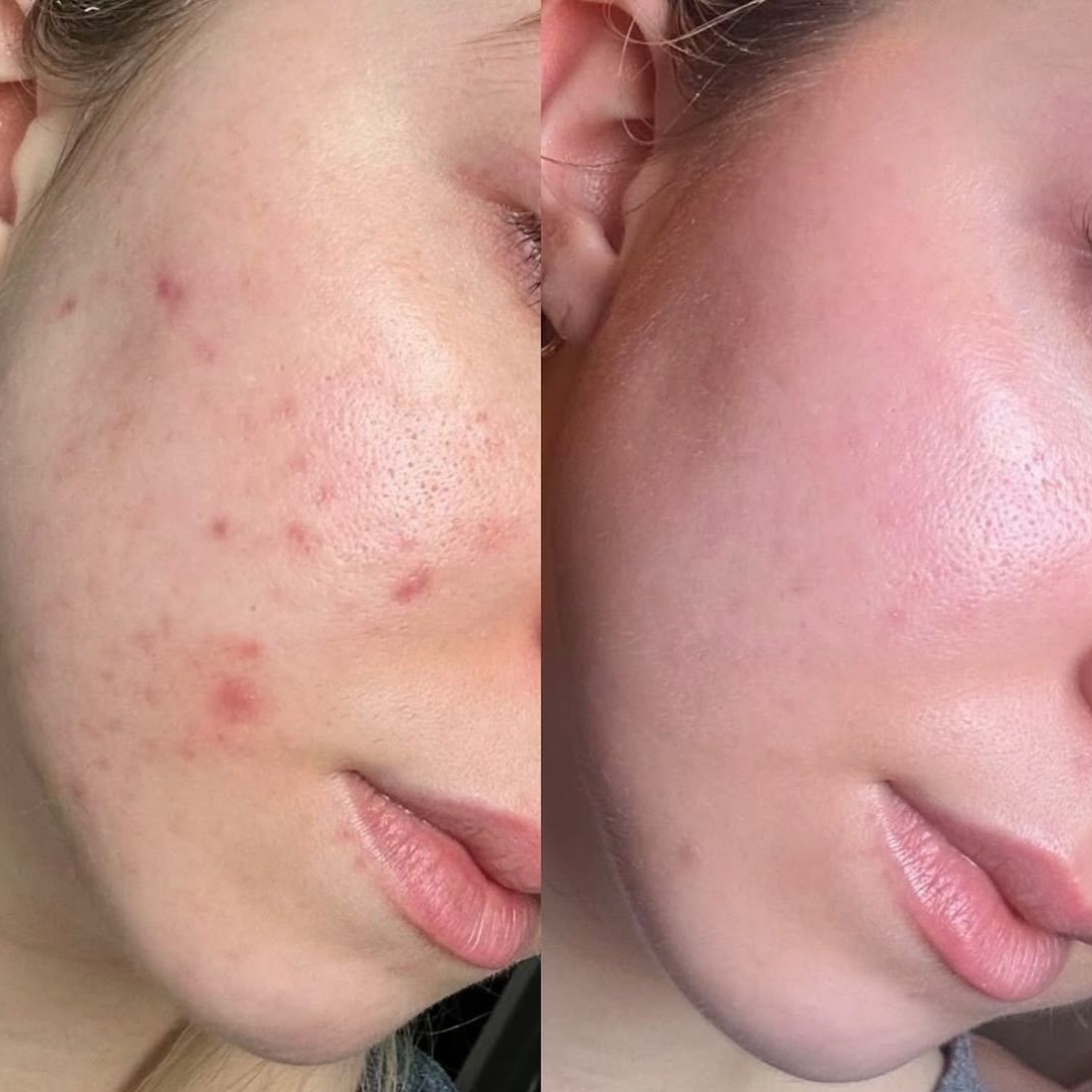 Arencia Vitamin C Booster Shot – Vitamin C Booster for Dark Spots, Uneven Tone, Fine Lines & Dullness – Deep Hydration, Antioxidant Protection