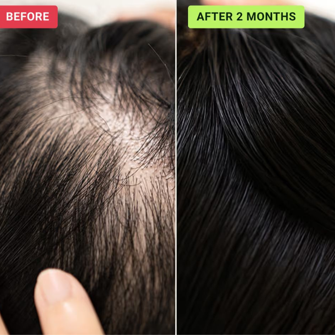 Tgideas Rosemary Amino Acid Shampoo – Strengthens Hair Roots, Promotes Hair Growth, Reduces Hair Fall – Deep Cleansing, Nourishing & Safe – For Dandruff, Oily Scalp, Dry & Frizzy Hair