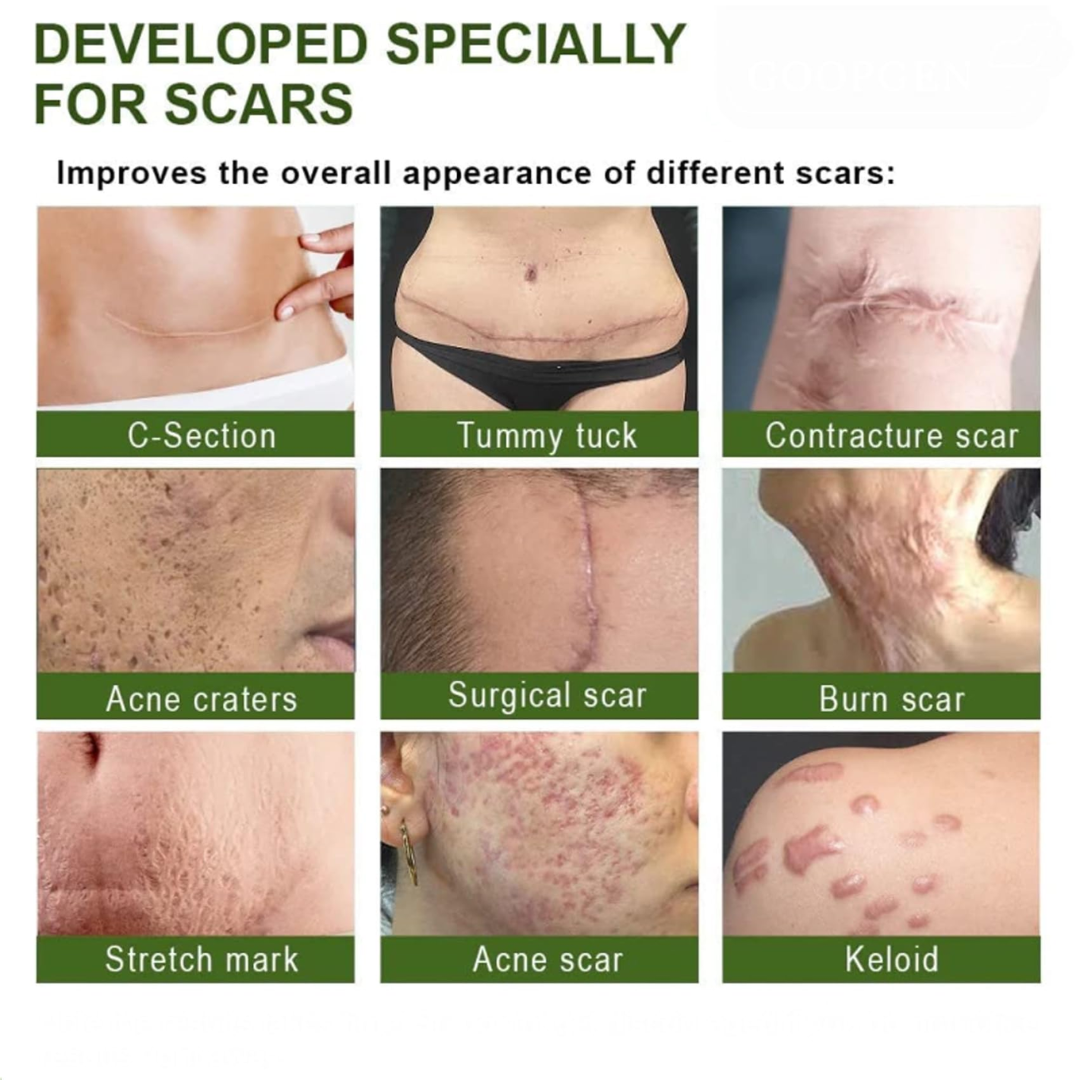 Hakim Suleman's Stretch Mark & Scar Removal Cream | Enriched with Almond, Olive & Sandalwood Oil | Reduces Stretch Marks, Scars & Improves Skin Elasticity