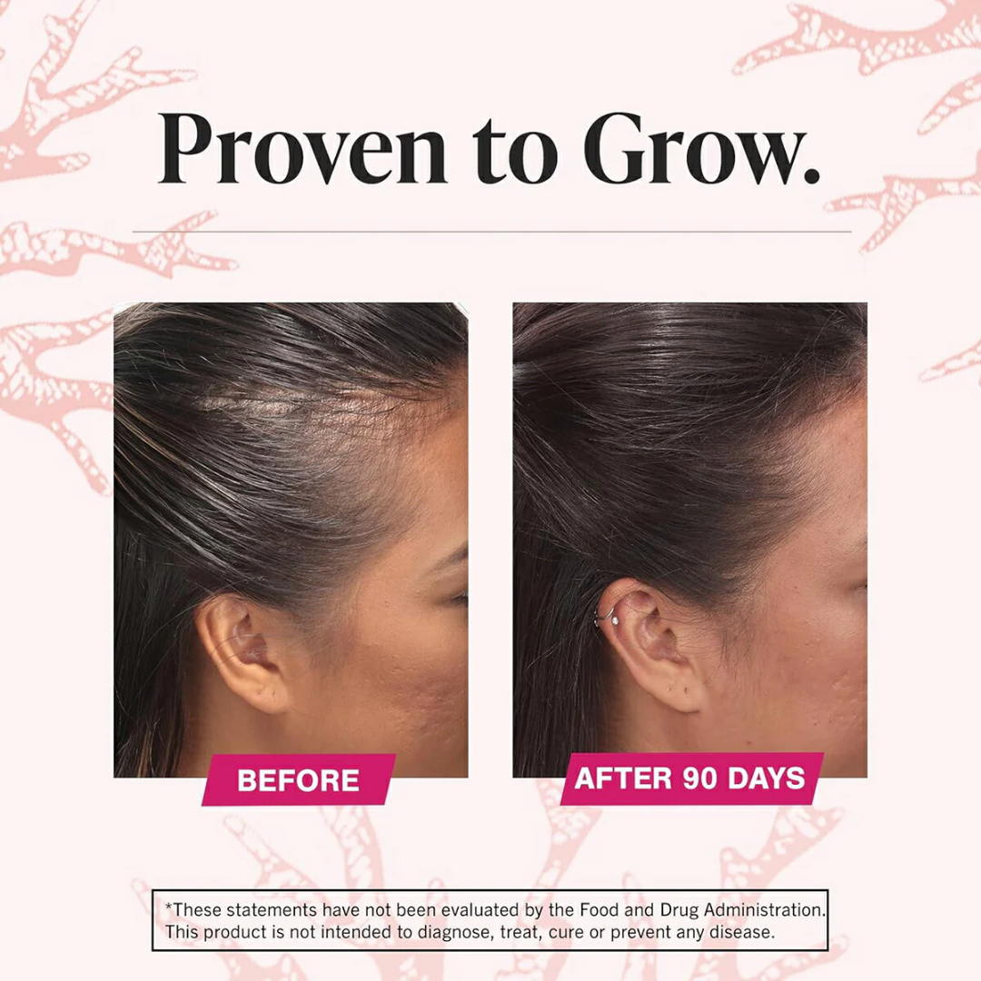 Bare Anatomy Advanced Hair Growth Serum | 3% Redensyl + 4% Anagain + 3% Baicapil + 1% Capilia Longa | Clinically Proven to Reduce Hair Fall & Boost Regrowth