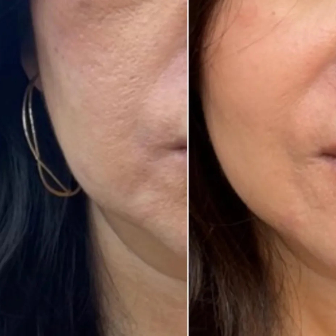 mixsoon Bean Essence – 50% OFF – Nourish, Refine & Reveal Radiance – Minimal Ingredients, Maximum Results – Smooths Texture, Deeply Hydrates, Refines Pores, Boosts Glow