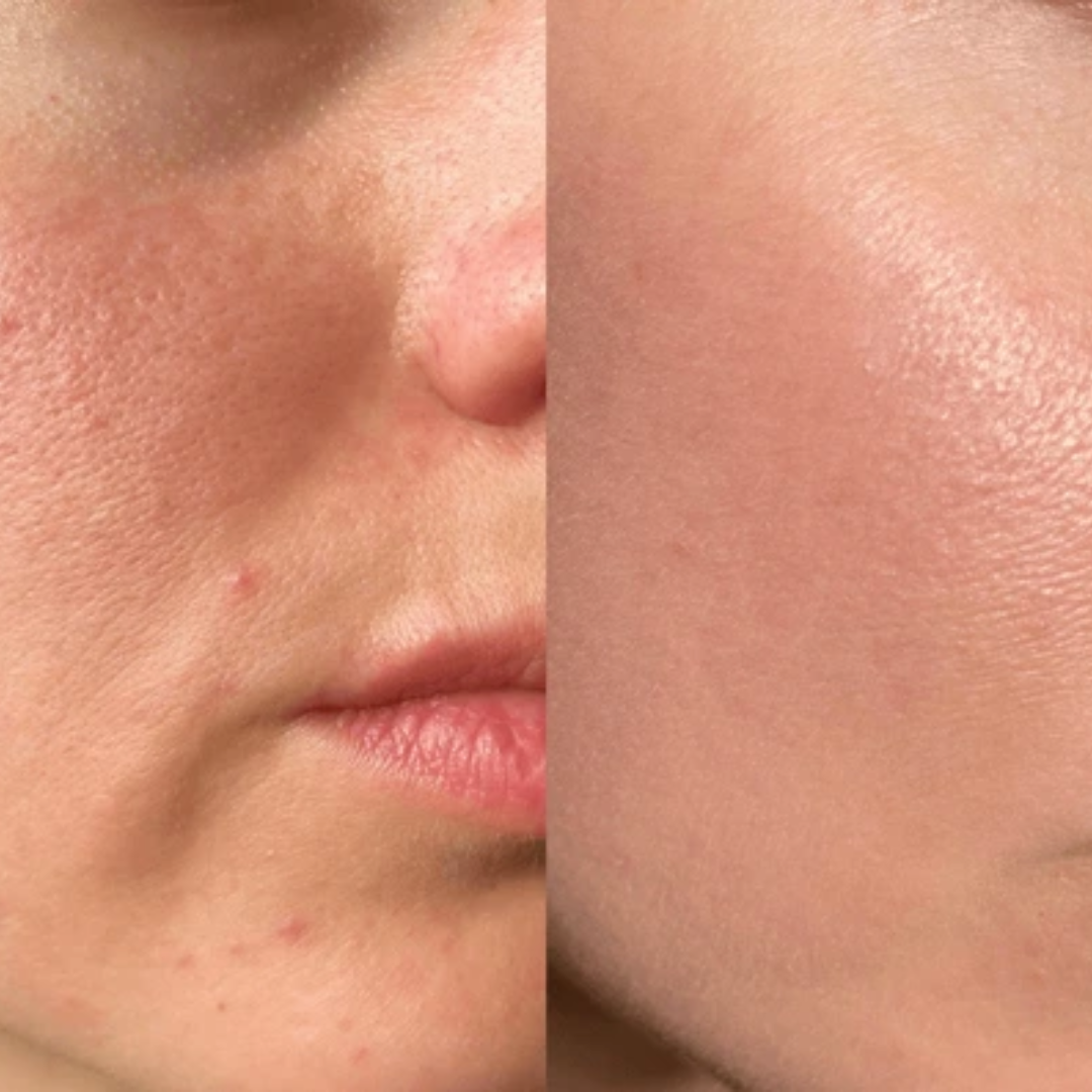 RENEE Immortal Face Cream | All-in-One Moisturizer | Nourishes, Repairs, Renews & Protects | Remove pigmentation, dark spots & brighten skin tone | For All Skin Types