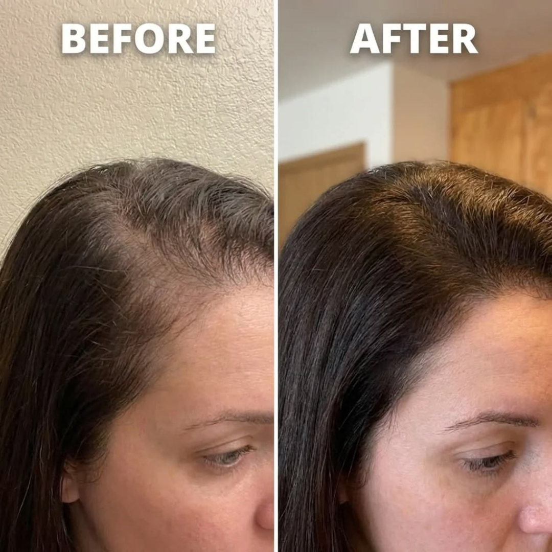 Tgideas Rosemary Amino Acid Shampoo – Strengthens Hair Roots, Promotes Hair Growth, Reduces Hair Fall – Deep Cleansing, Nourishing & Safe – For Dandruff, Oily Scalp, Dry & Frizzy Hair