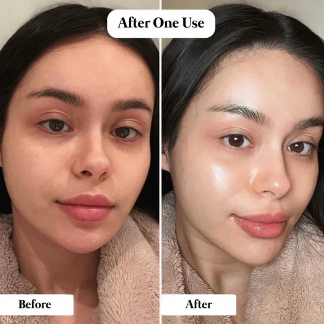 Dr. Melaxin Peel Shot Exfoliating Black Rice Ampoule | Gommage Peeling with Rice Water, Niacinamide & AHA/BHA | Removes Blackheads, Unclogs Pores & Smooths Skin
