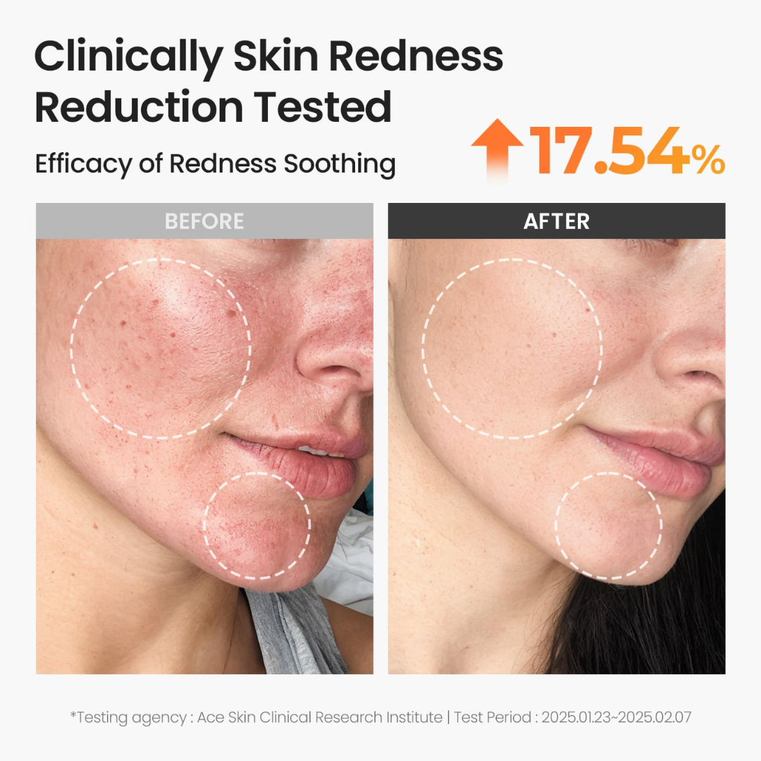Muse Labs 7% Glycolic Acid Toner | Gentle AHA Exfoliant with Niacinamide & Aloe Vera | Smooth, Bright & Clear Skin