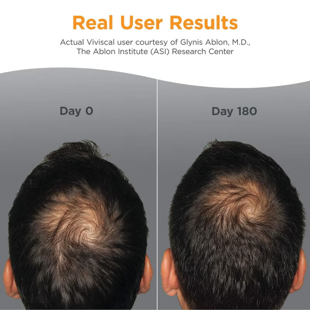 Bare Anatomy Advanced Hair Growth Serum | 3% Redensyl + 4% Anagain + 3% Baicapil + 1% Capilia Longa | Clinically Proven to Reduce Hair Fall & Boost Regrowth