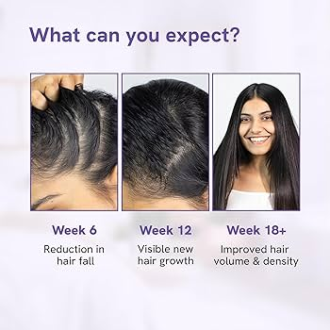 Bare Anatomy Advanced Hair Growth Roll-On Serum | 3% Redensyl + 4% Anagain + 2% Baicapil + 5% Rosemary | Direct Scalp Application for Thicker, Stronger Hair