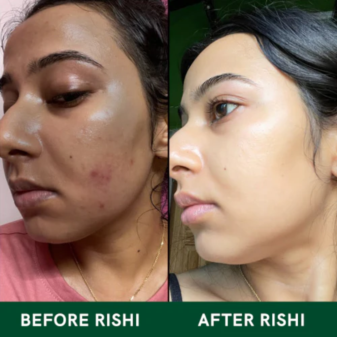 RENEE Immortal Face Cream | All-in-One Moisturizer | Nourishes, Repairs, Renews & Protects | Remove pigmentation, dark spots & brighten skin tone | For All Skin Types
