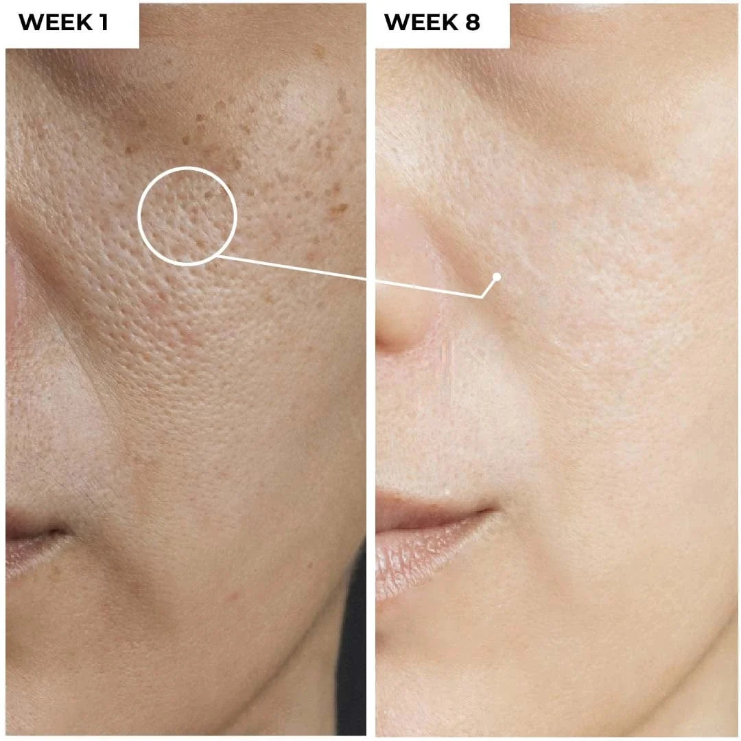 mixsoon Bean Essence – 50% OFF – Nourish, Refine & Reveal Radiance – Minimal Ingredients, Maximum Results – Smooths Texture, Deeply Hydrates, Refines Pores, Boosts Glow