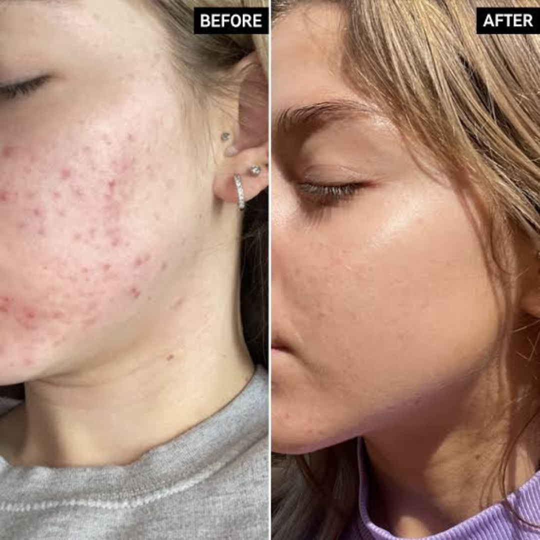 mixsoon Bean Essence – 50% OFF – Nourish, Refine & Reveal Radiance – Minimal Ingredients, Maximum Results – Smooths Texture, Deeply Hydrates, Refines Pores, Boosts Glow