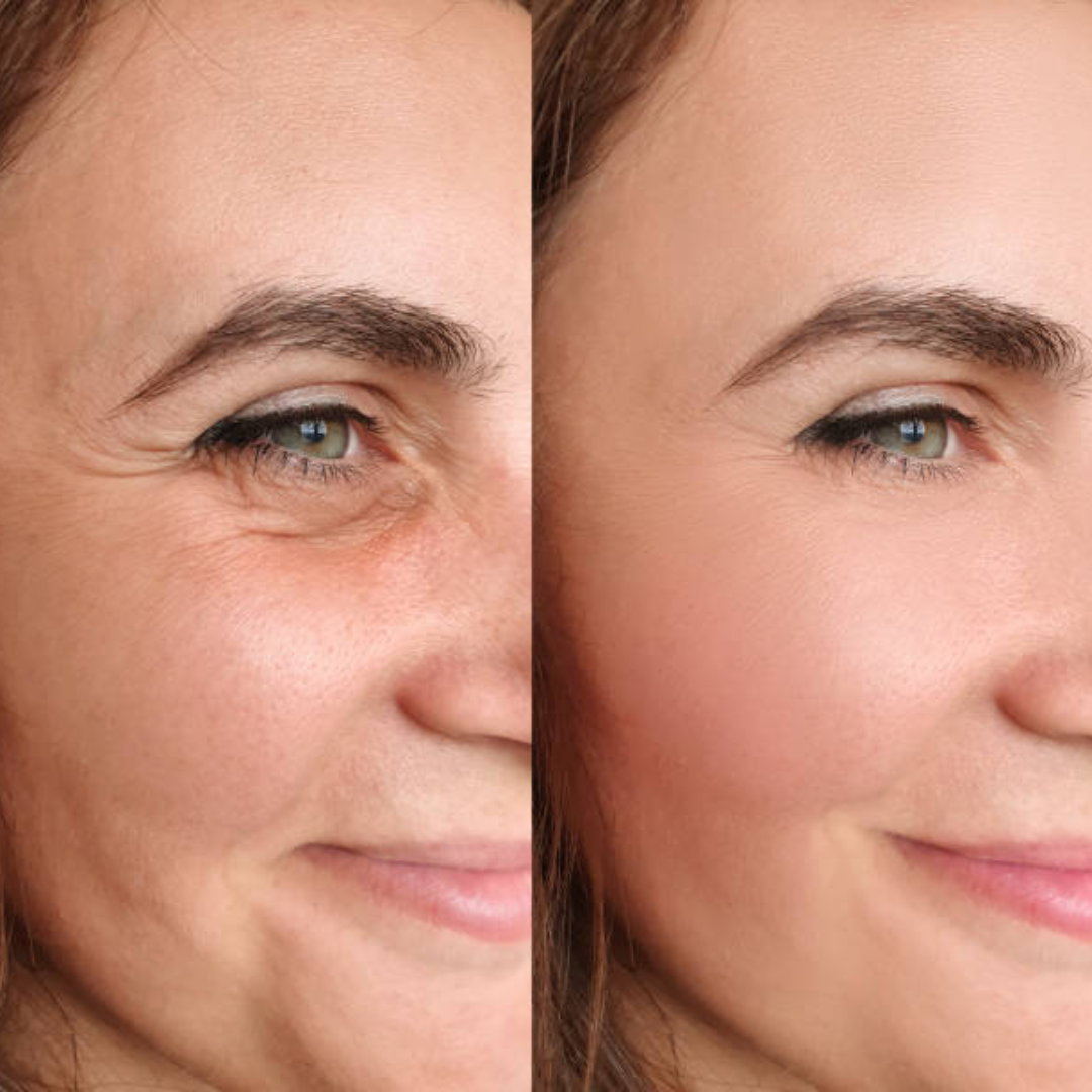 Dr. Melaxin Calcium & Collagen Balm Stick | Repair Wrinkles & Repair Skin Cells | Tighten Skin tissues & Brighten Skin