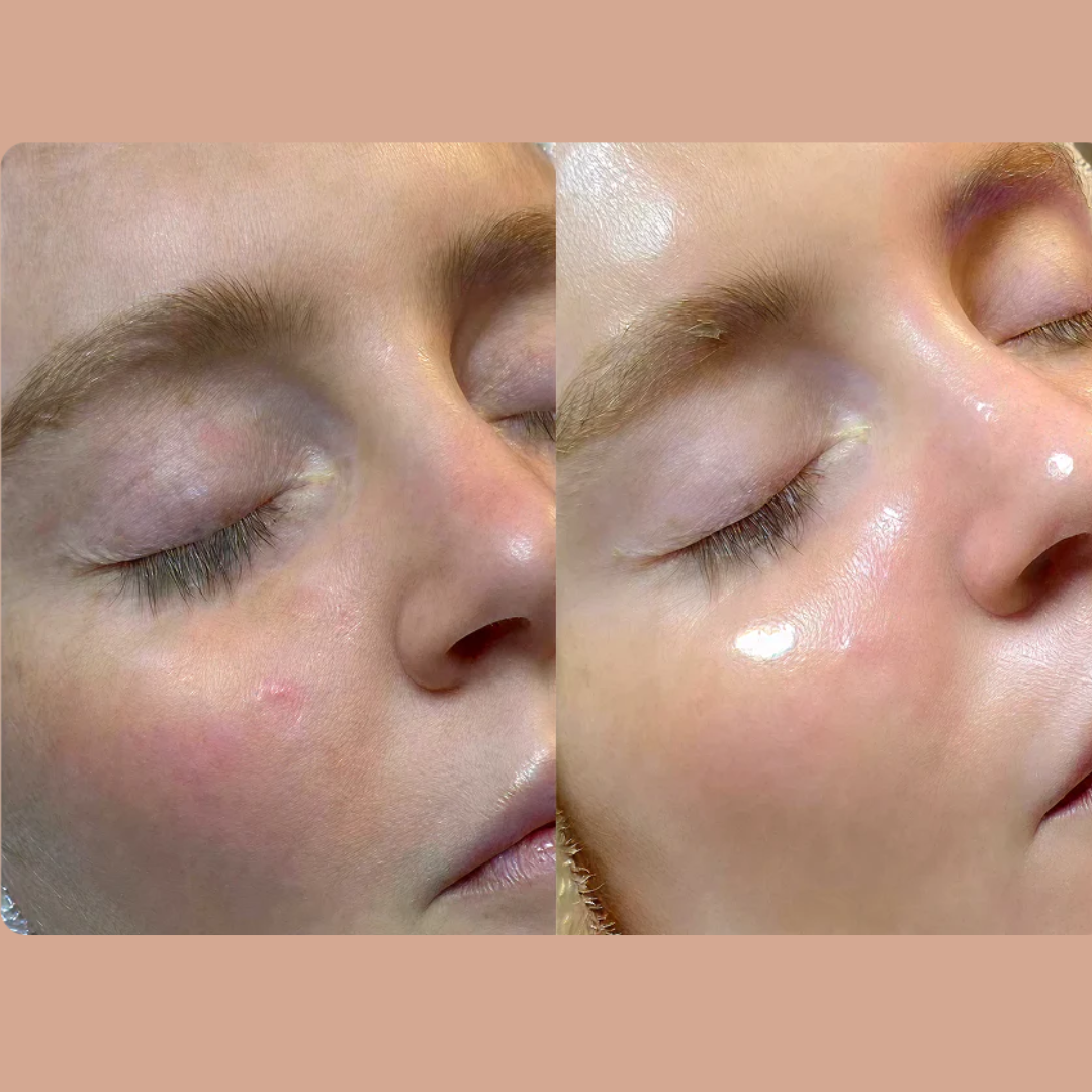 Muse Labs 7% Glycolic Acid Toner | Gentle AHA Exfoliant with Niacinamide & Aloe Vera | Smooth, Bright & Clear Skin