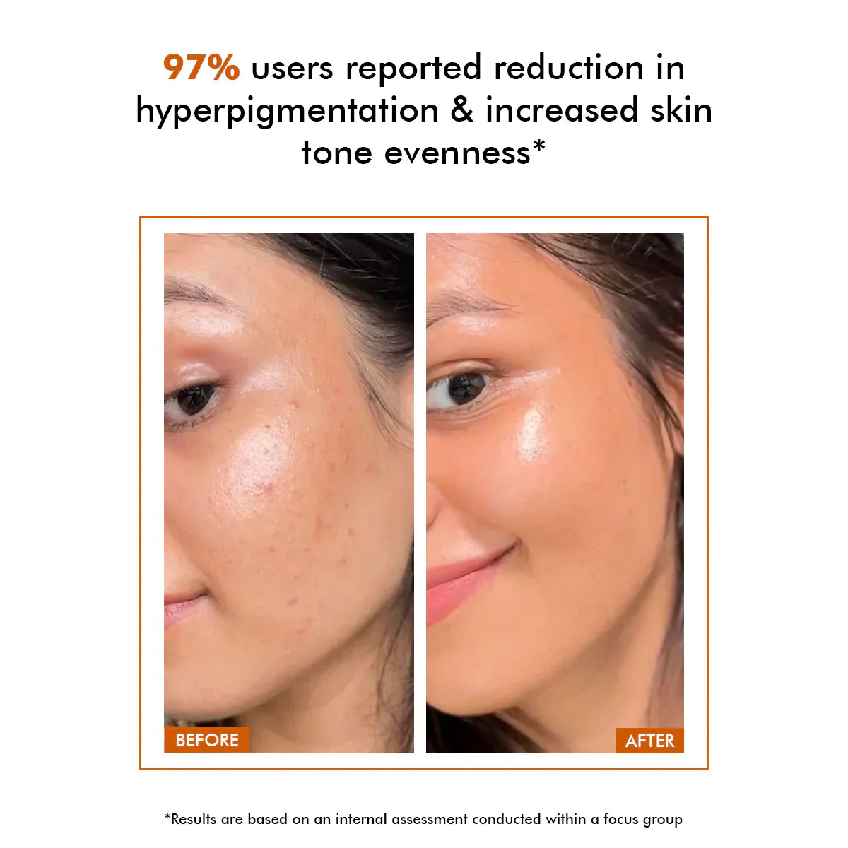 The Muse Labs C-Bright Serum | Brighter, Smoother & Even-Toned Skin in Just 3 Days