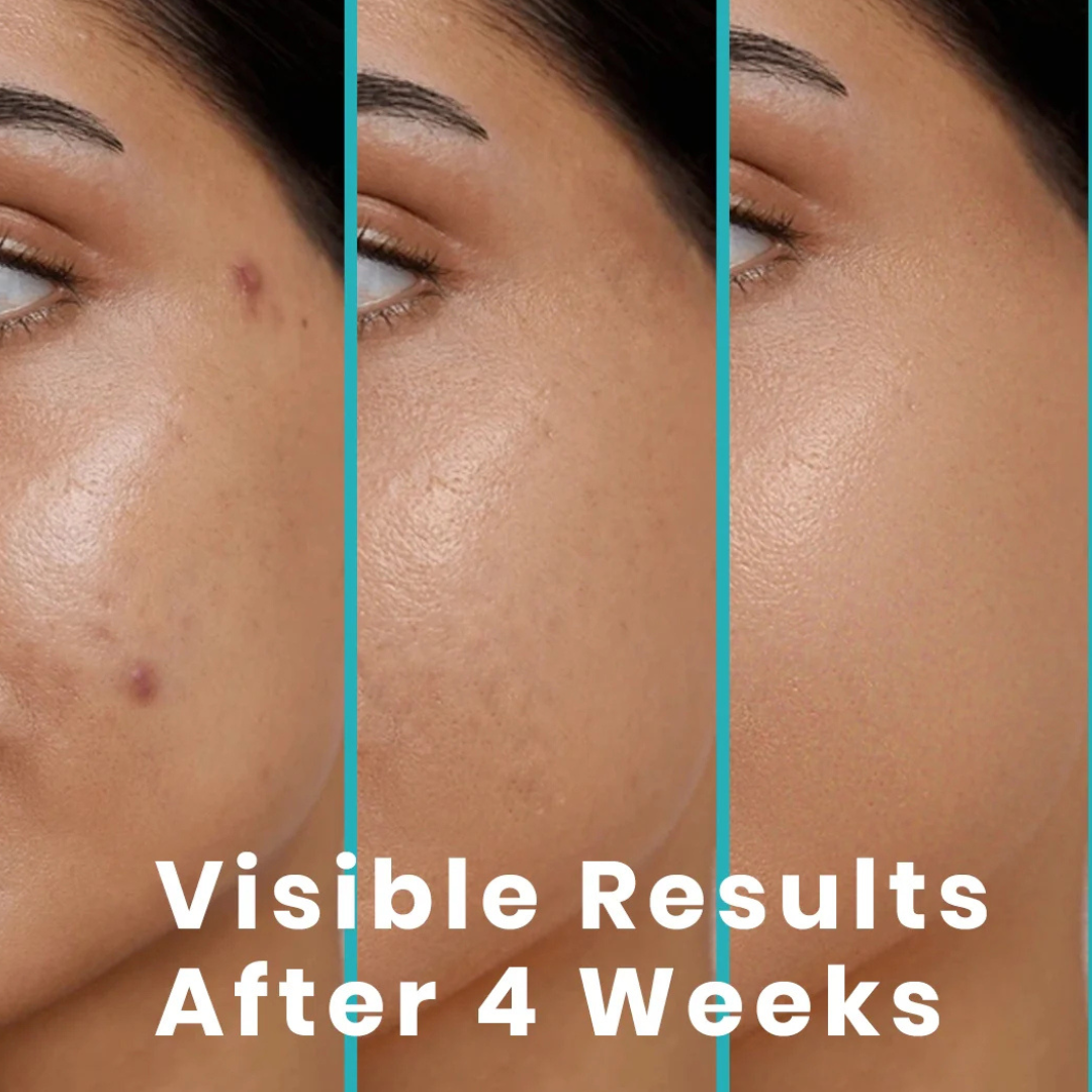 RENEE Immortal Face Cream | All-in-One Moisturizer | Nourishes, Repairs, Renews & Protects | Remove pigmentation, dark spots & brighten skin tone | For All Skin Types