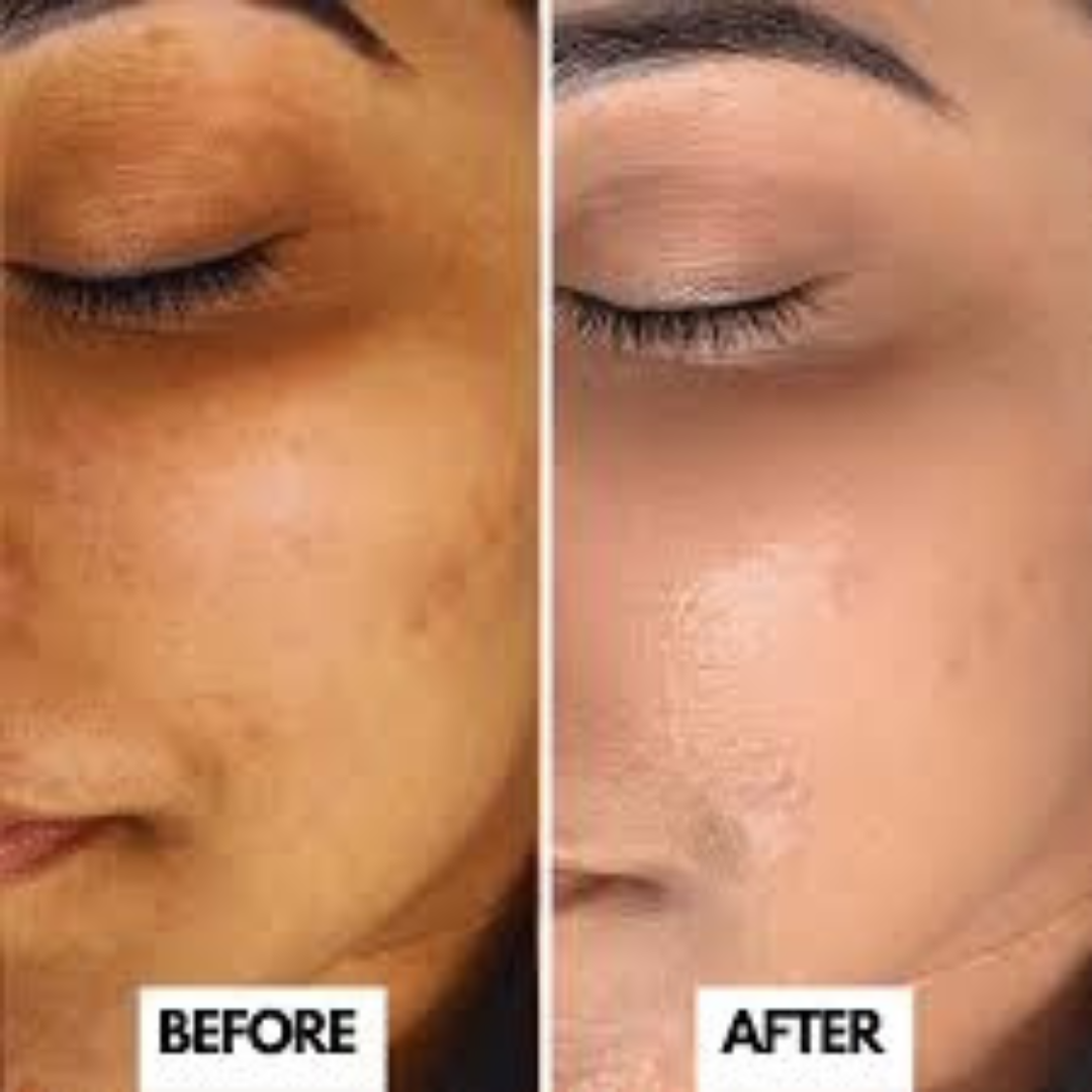L'Oreal pink Exfoliating Peel | Facial Like Glow in Just 15 minutes | Anti dark spot, Pore minimizing, Brighten Skin tone