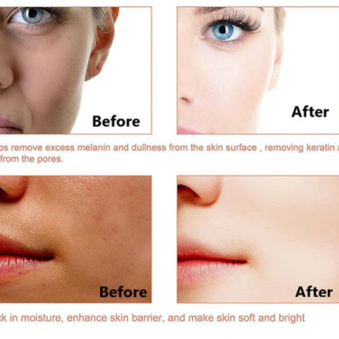 L'Oreal pink Exfoliating Peel | Facial Like Glow in Just 15 minutes | Anti dark spot, Pore minimizing, Brighten Skin tone