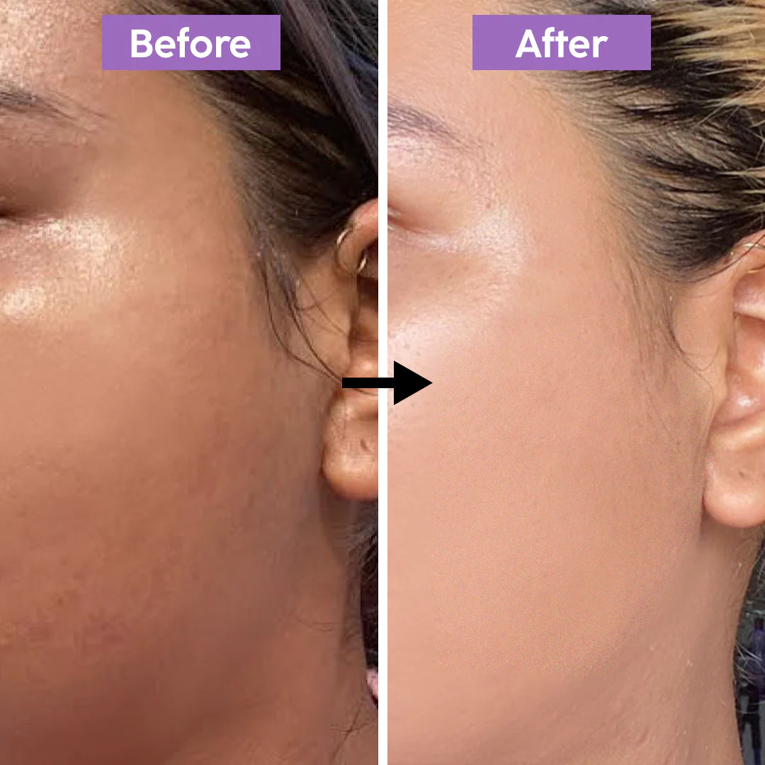 RENEE Immortal Face Cream | All-in-One Moisturizer | Nourishes, Repairs, Renews & Protects | Remove pigmentation, dark spots & brighten skin tone | For All Skin Types