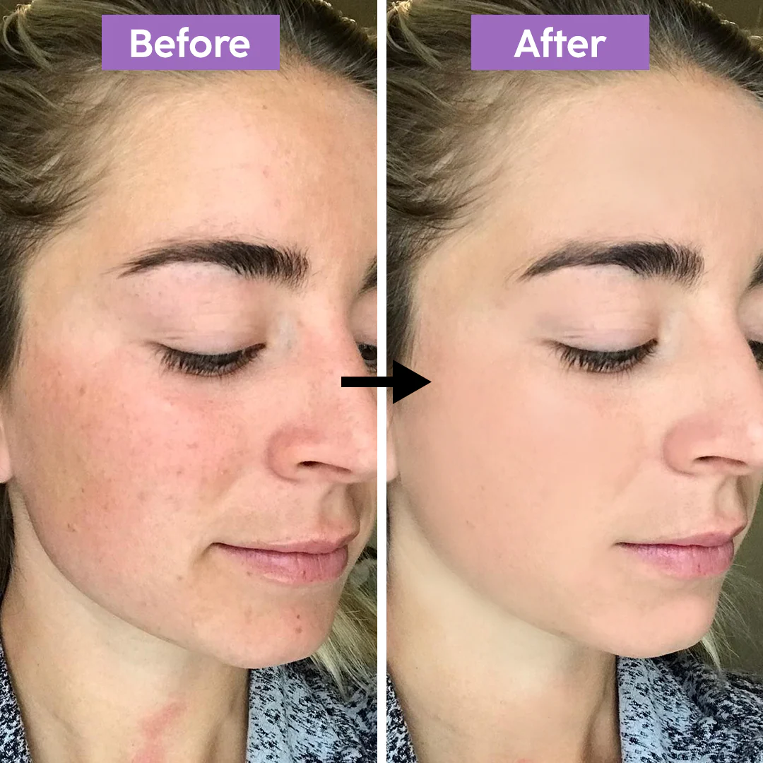 All in one High Coverage Tender Cream | Conceal, Cover & Hydration | Light weight & long-lasting | For all Skin Types