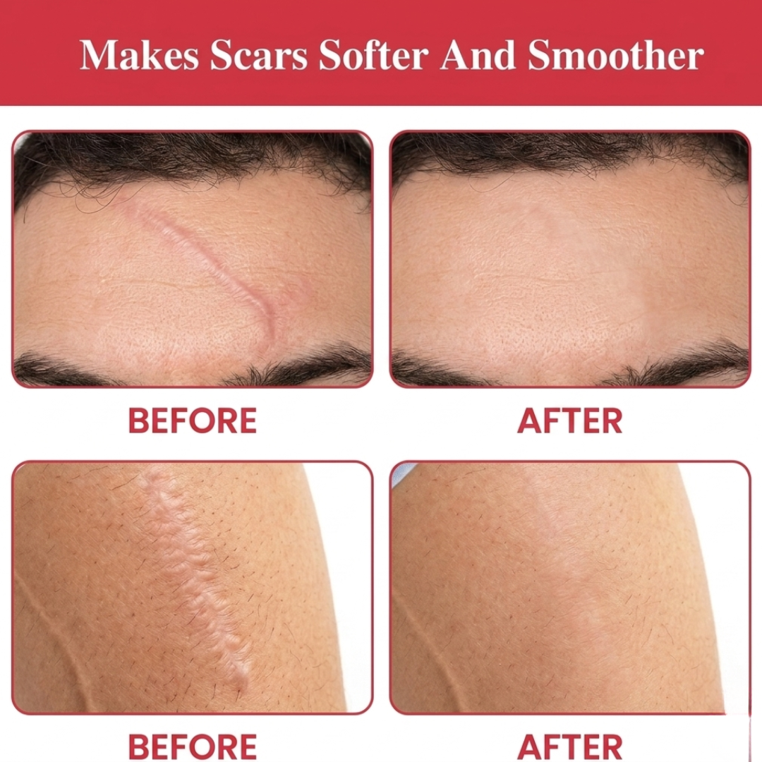 Laniska Scar Soothing Cream | 7-in-1 Skin Repair with Argan Oil, Shea Butter, Vitamin E & Hyaluronic Acid | Fades Scars, Warts & Scratches, Deep Hydration
