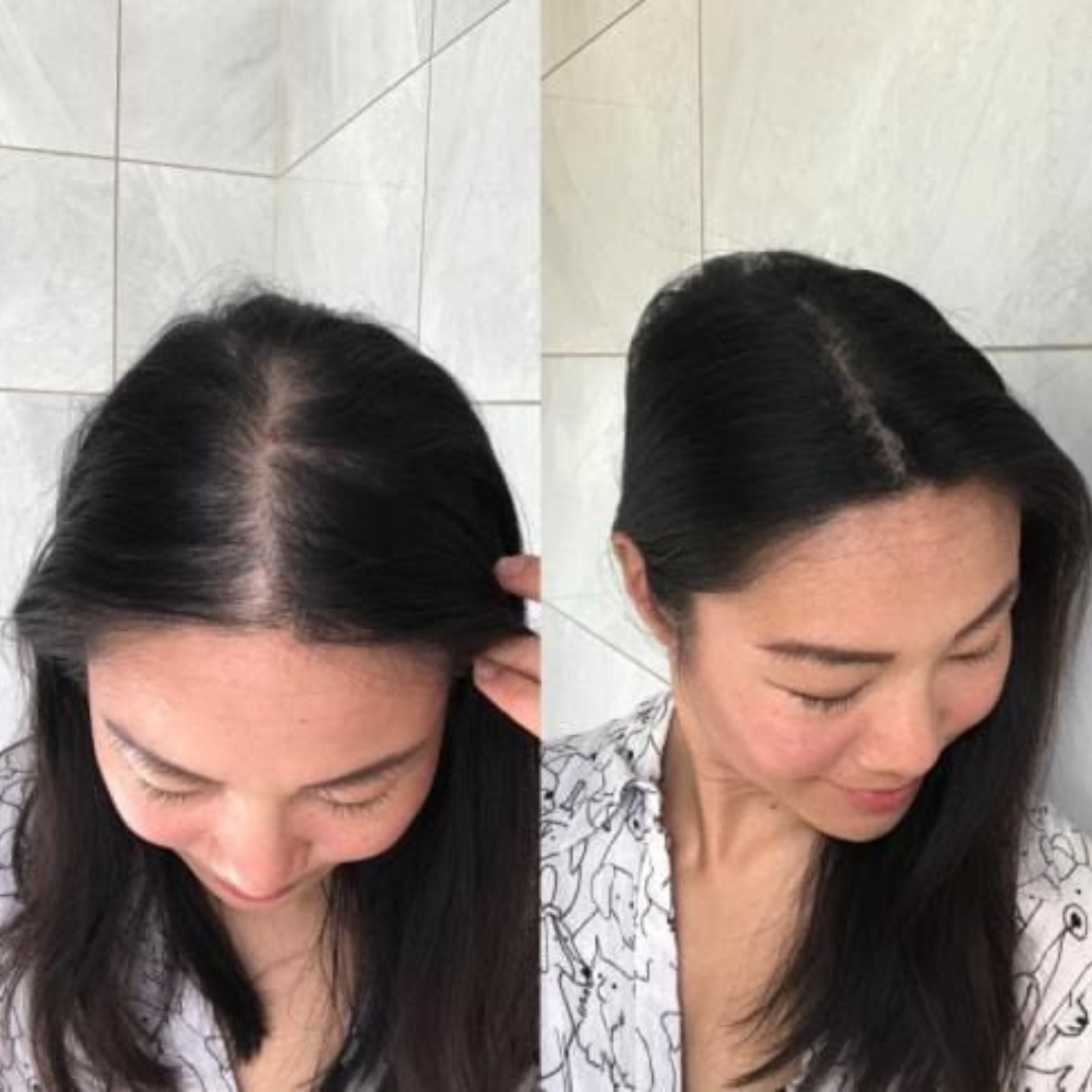 Tgideas Rosemary Amino Acid Shampoo – Strengthens Hair Roots, Promotes Hair Growth, Reduces Hair Fall – Deep Cleansing, Nourishing & Safe – For Dandruff, Oily Scalp, Dry & Frizzy Hair