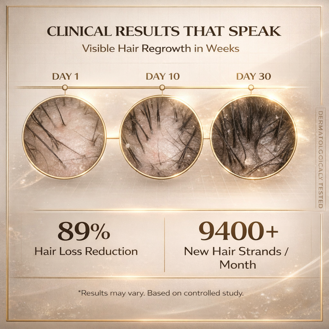 Bare Anatomy Advanced Hair Growth Serum | 3% Redensyl + 4% Anagain + 3% Baicapil + 1% Capilia Longa | Clinically Proven to Reduce Hair Fall & Boost Regrowth