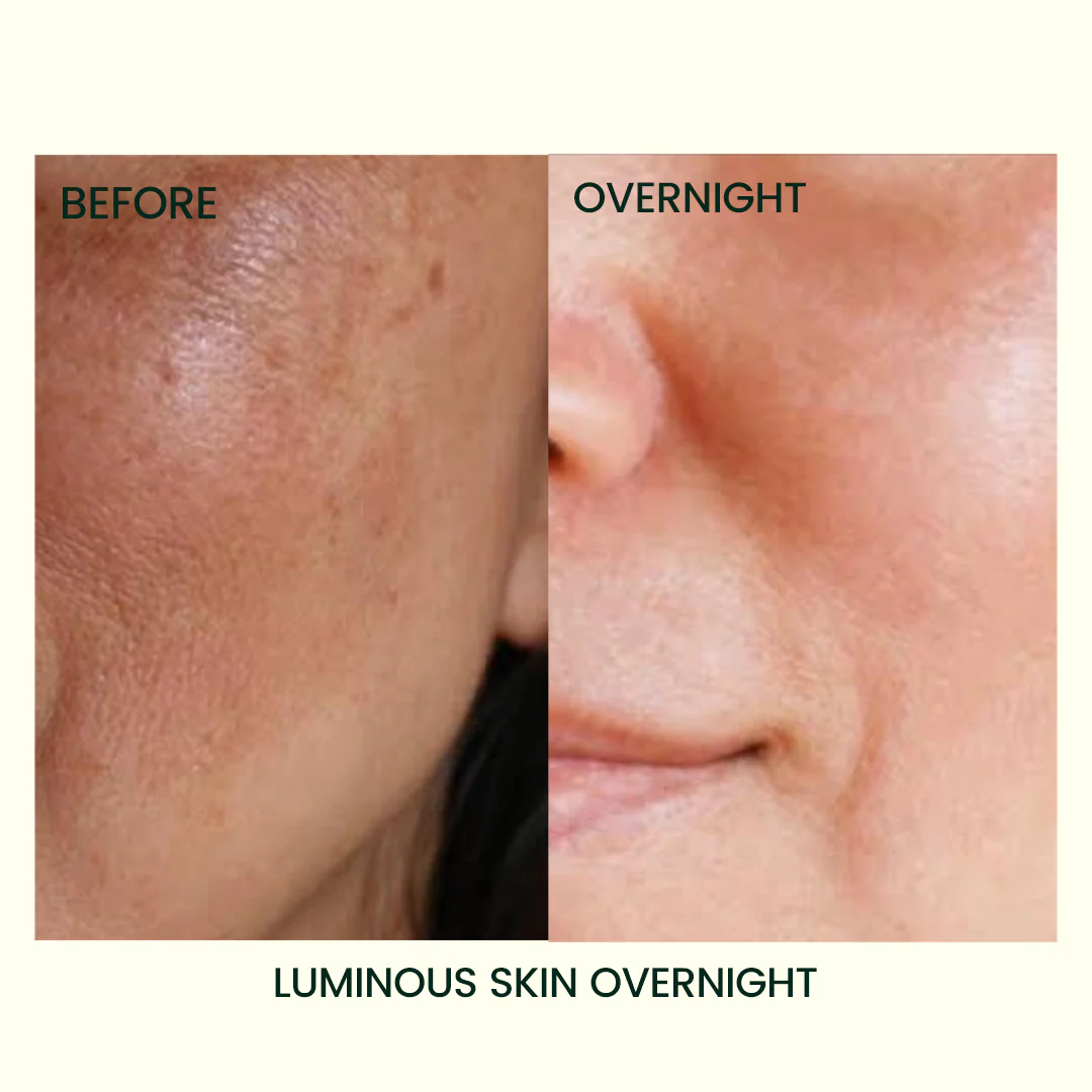 The Muse Labs C-Bright Serum | Brighter, Smoother & Even-Toned Skin in Just 3 Days