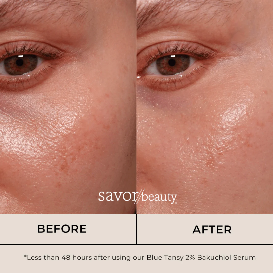 The Muse Labs C-Bright Serum | Brighter, Smoother & Even-Toned Skin in Just 3 Days