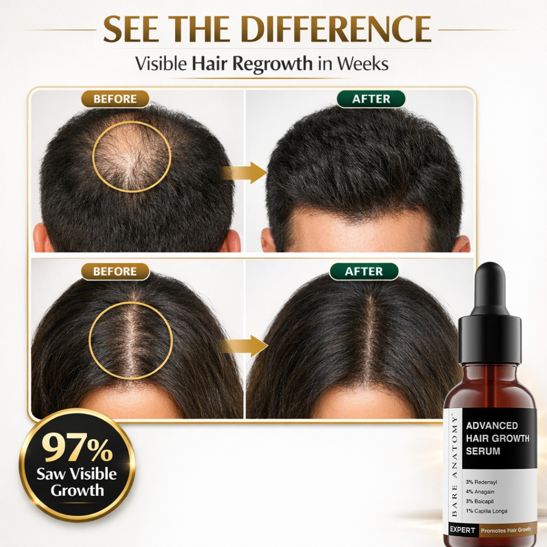Bare Anatomy Advanced Hair Growth Serum | 3% Redensyl + 4% Anagain + 3% Baicapil + 1% Capilia Longa | Clinically Proven to Reduce Hair Fall & Boost Regrowth