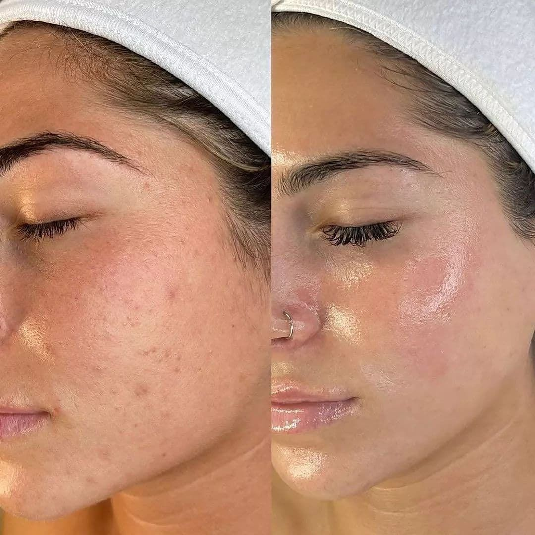Aroma Magic 7 Step Bridal Glow Facial Kit – Salon Range – Enhances Natural Glow, Imparts Dazzling Radiance, Revitalises From Within – Complete 7-Step Facial at Home – For All Skin Types