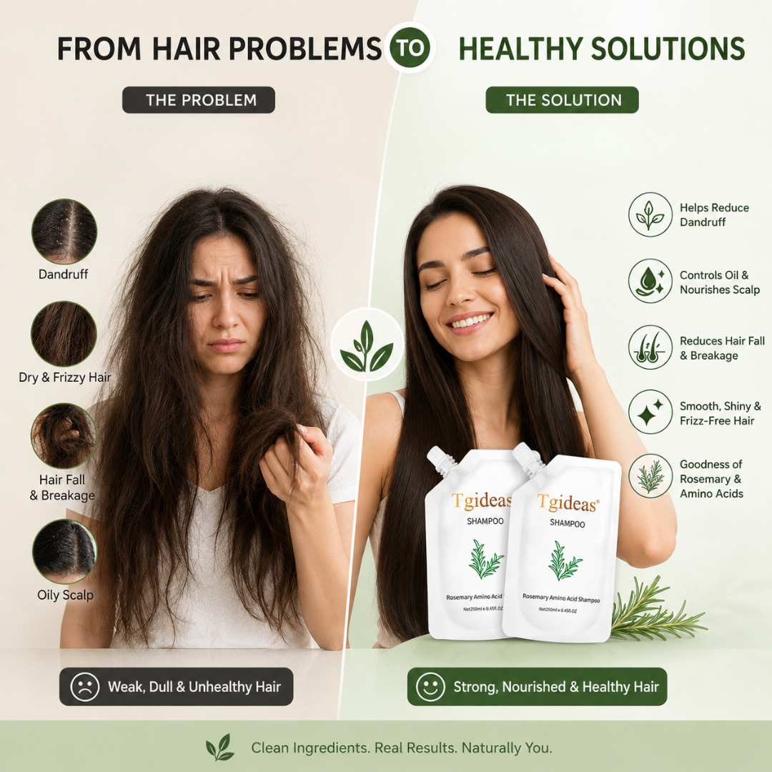 Tgideas Rosemary Amino Acid Shampoo – Strengthens Hair Roots, Promotes Hair Growth, Reduces Hair Fall – Deep Cleansing, Nourishing & Safe – For Dandruff, Oily Scalp, Dry & Frizzy Hair