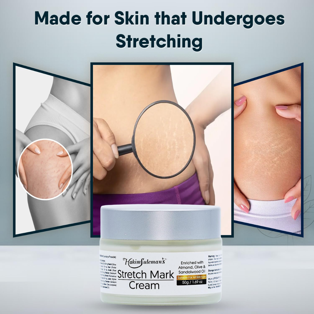 Hakim Suleman's Stretch Mark & Scar Removal Cream | Enriched with Almond, Olive & Sandalwood Oil | Reduces Stretch Marks, Scars & Improves Skin Elasticity
