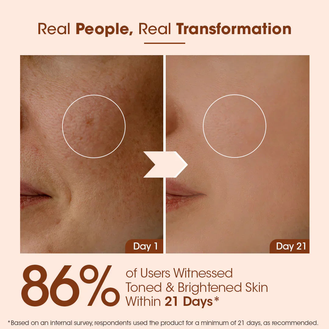 The Muse Labs C-Bright Serum | Brighter, Smoother & Even-Toned Skin in Just 3 Days