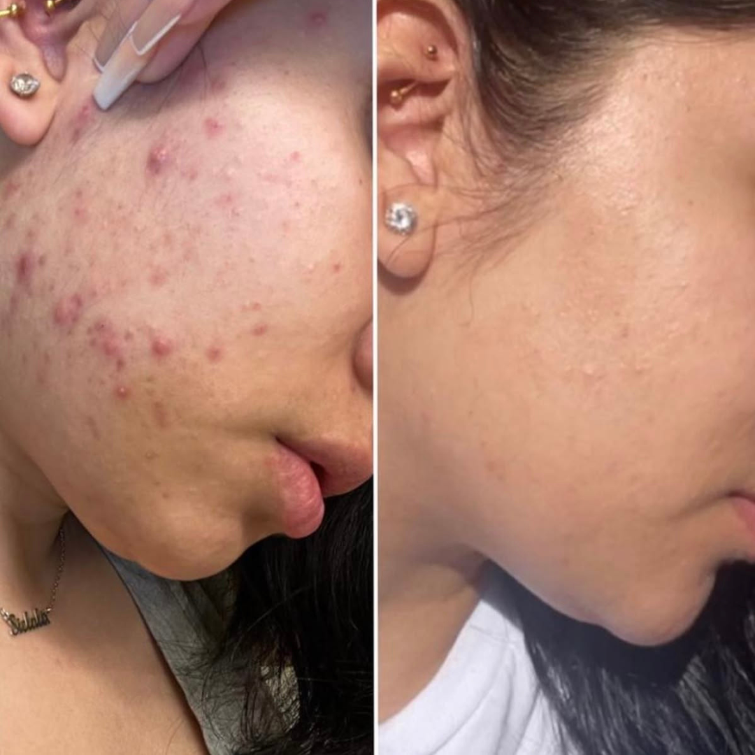 Arencia Vitamin C Booster Shot – Vitamin C Booster for Dark Spots, Uneven Tone, Fine Lines & Dullness – Deep Hydration, Antioxidant Protection