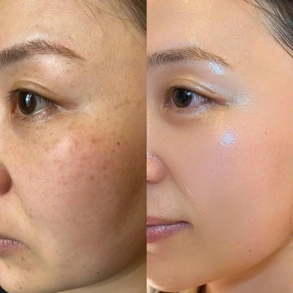 SUROSKIE Triple C Glow Capsule Cream | Brightens Uneven Skin | Deep Hydration | Healthy Radiant Glow