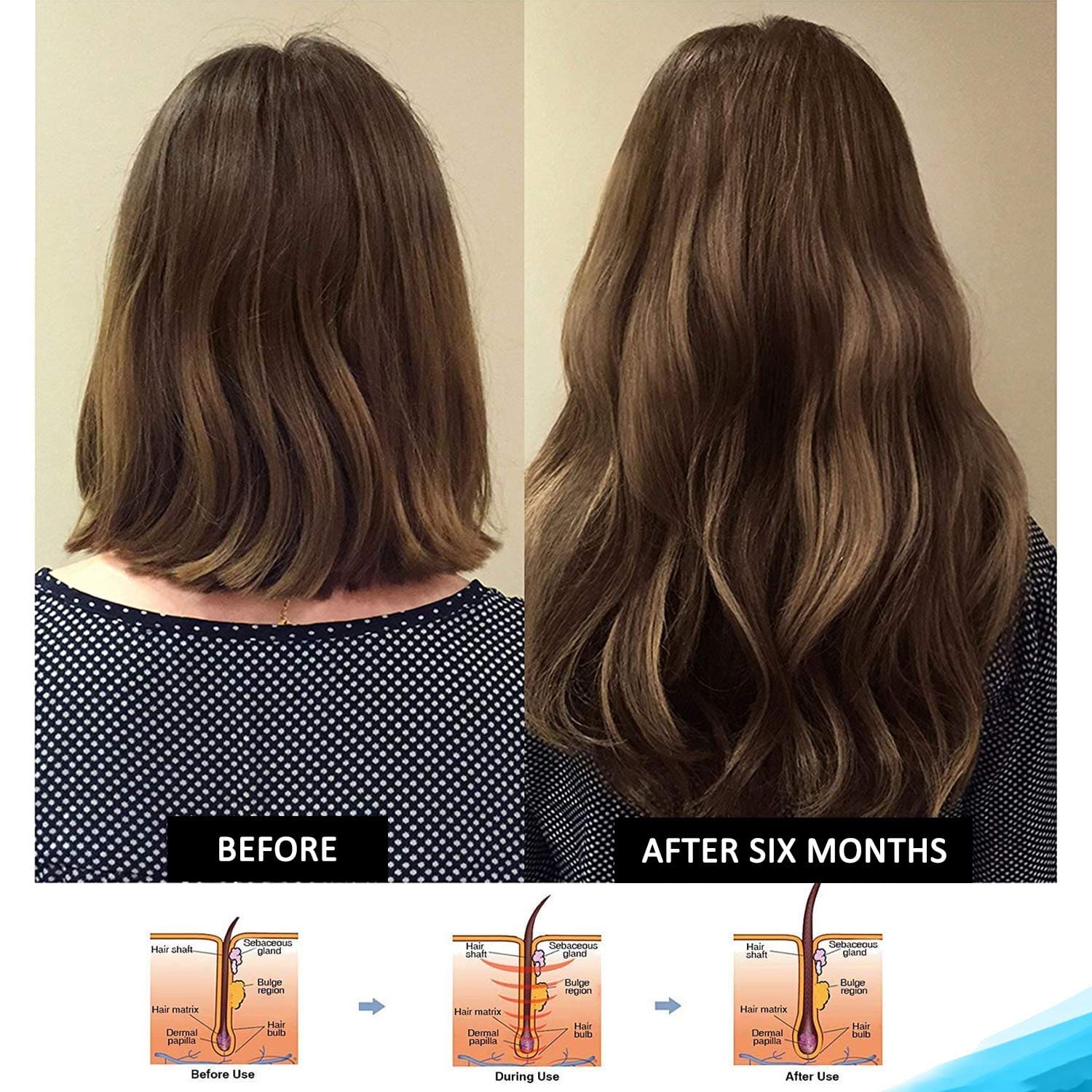 Tgideas Rosemary Amino Acid Shampoo – Strengthens Hair Roots, Promotes Hair Growth, Reduces Hair Fall – Deep Cleansing, Nourishing & Safe – For Dandruff, Oily Scalp, Dry & Frizzy Hair