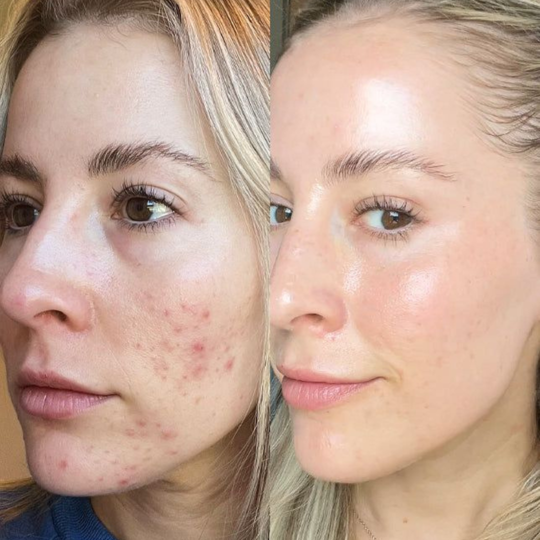 Arencia Vitamin C Booster Shot – Vitamin C Booster for Dark Spots, Uneven Tone, Fine Lines & Dullness – Deep Hydration, Antioxidant Protection