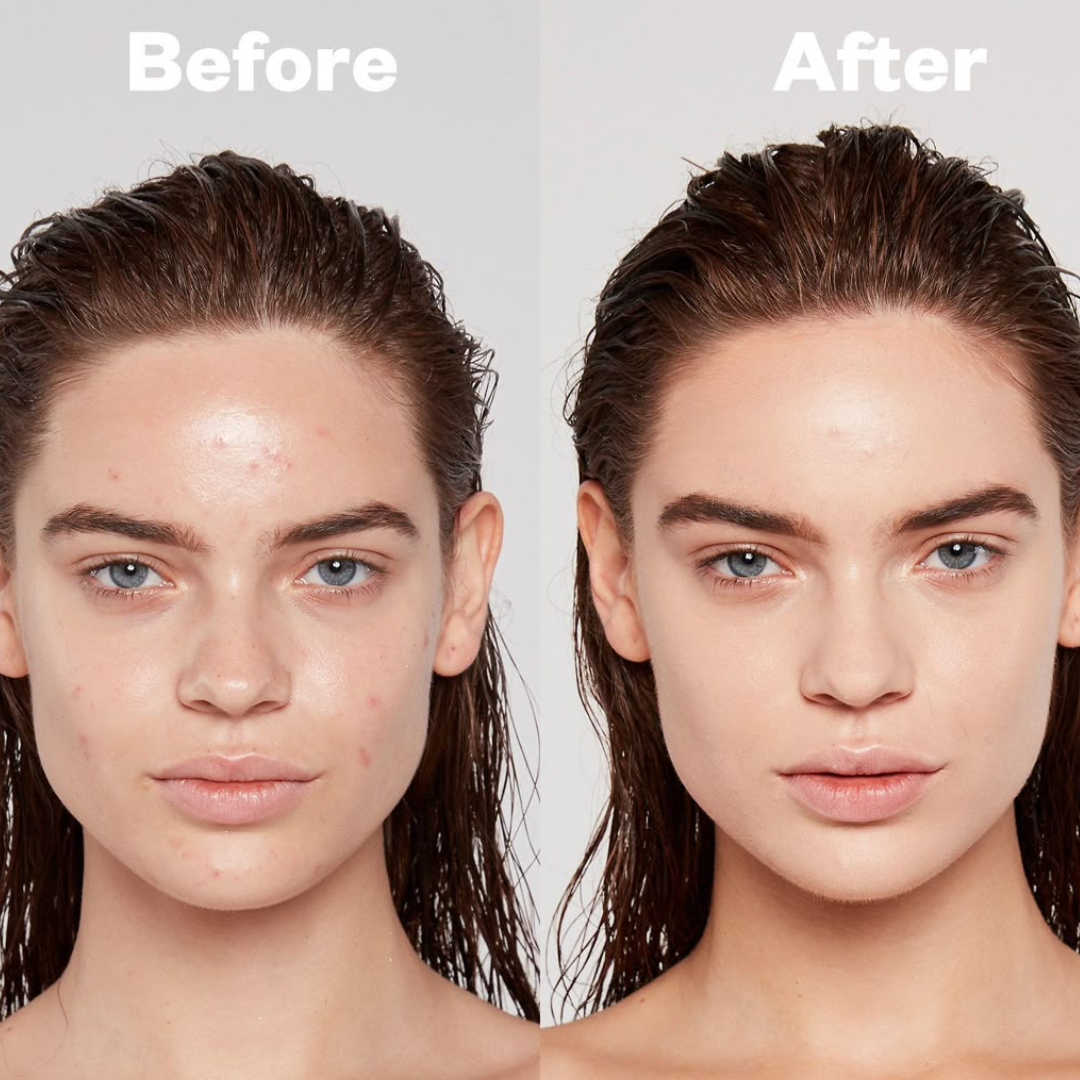 Maybelline New York Spot Rescue Concealer - Full Coverage Skin-Improving Concealer + Salicylic Acid – Conceals Acne & Blemishes, Improves Skin Over Time – 12HR Long-Lasting