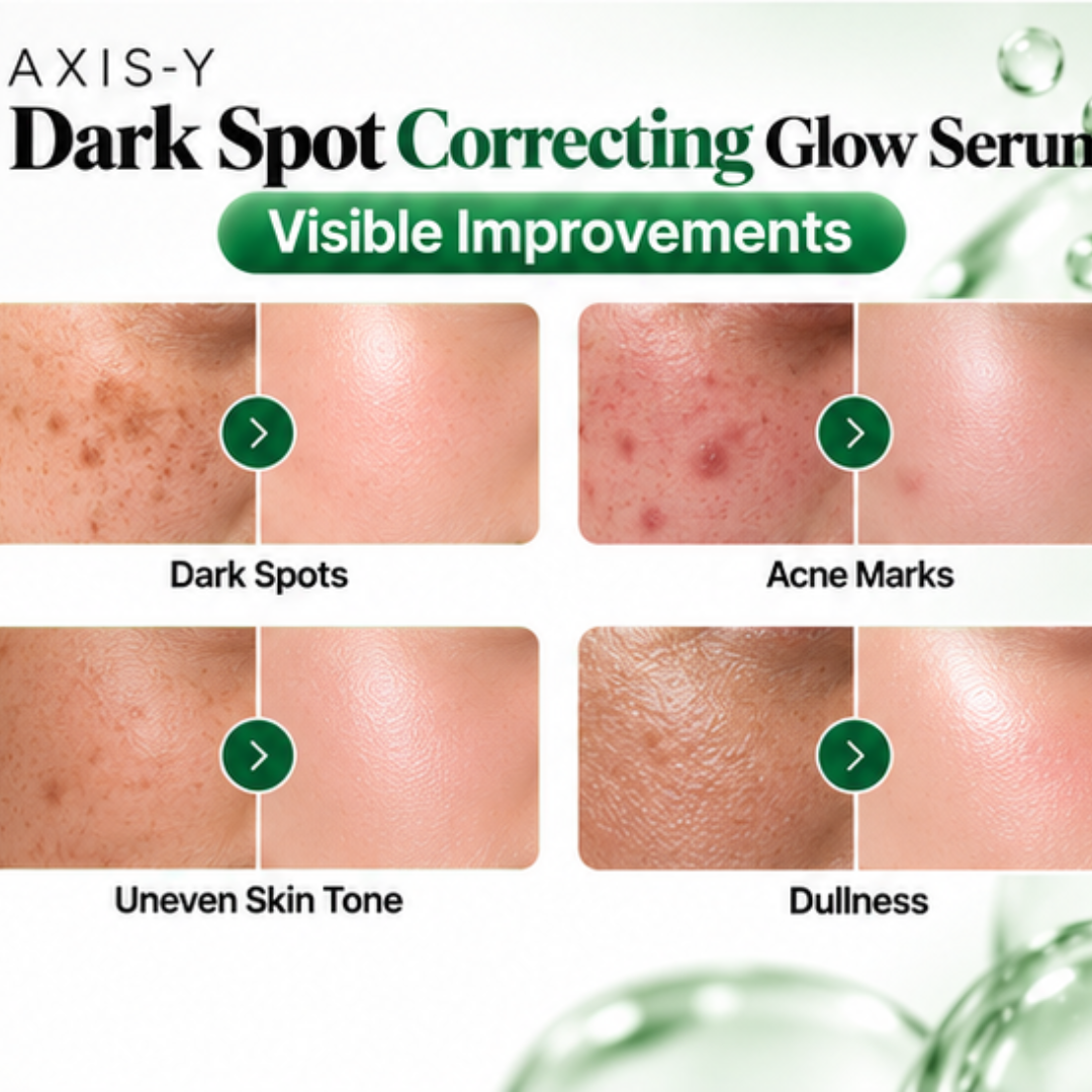 AXIS-Y Dark Spot Correcting Glow Serum – 5% Niacinamide & Squalane – Fades Dark Spots, Acne , Pigmentation & Evens Tone - Give bright & Clean Glowing Skin