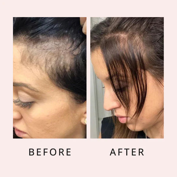 Tgideas Rosemary Amino Acid Shampoo – Strengthens Hair Roots, Promotes Hair Growth, Reduces Hair Fall – Deep Cleansing, Nourishing & Safe – For Dandruff, Oily Scalp, Dry & Frizzy Hair